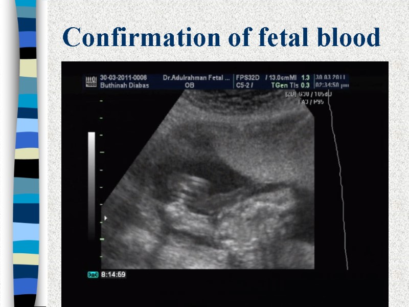 Confirmation of fetal blood